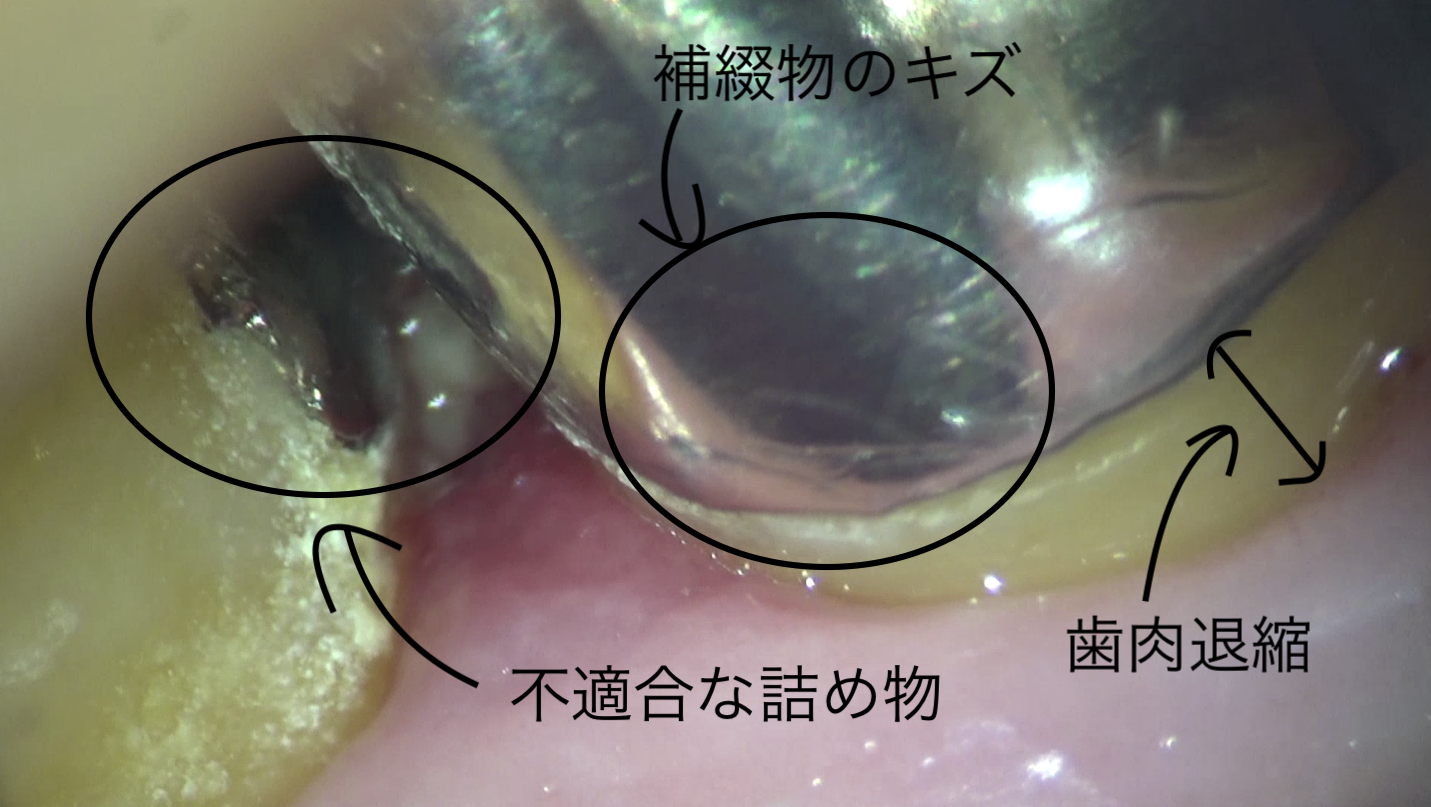 歯科衛生士は口の中の何をみているか？